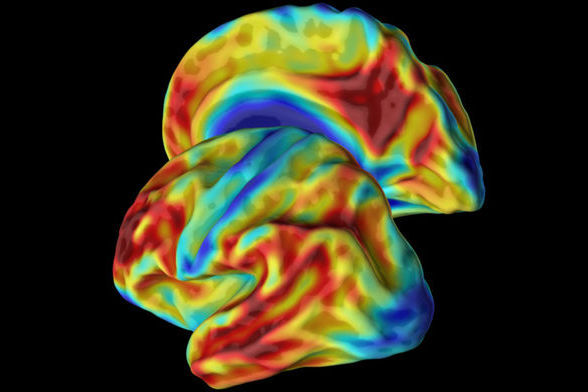 科学家发现一种罕见的基因变异，可让人不得老年痴呆