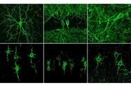 新型成像法可目击神经元工作过程