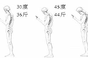 低头看手机等于脖子扛大米，低头党要注意了！
